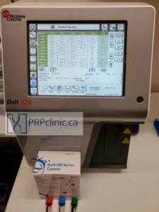 hematology analyzer used for PRP knee injection vancouver